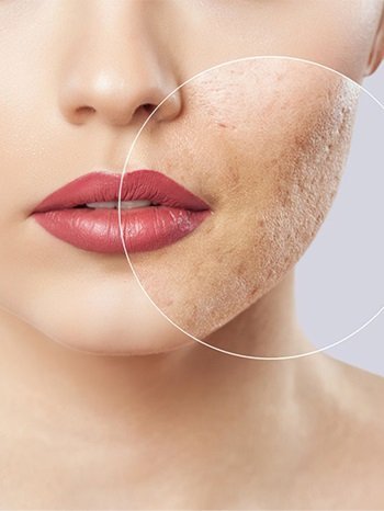 Mikrobiyom dengesi neden bozulur ve sonuçları nelerdir?