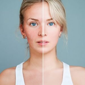 Diriliş Bitkisi Nedir ?