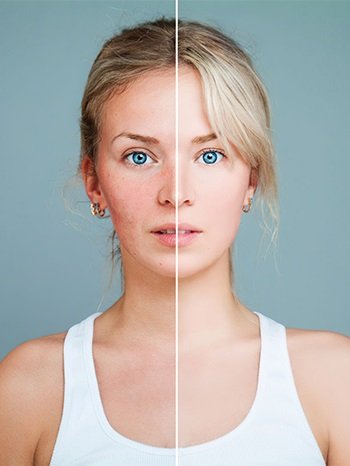 Diriliş Bitkisinin cilt üzerindeki etkileri nelerdir?